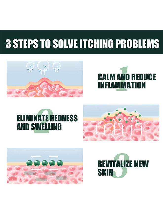 Sumifun كريم الصدفية لعلاج الحكة، علاج عشبي سريع، مرهم طبيعي علاجي مضاد للفطريات للتيبيا/ يخفف الحكة/ تغير اللون/ تهيج سريع المفعول للبشرة الجافة والحكة 20غ - Image 4