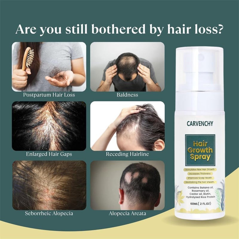 Hair Growth Serum, Natural Hair Growth for Women and Men, 60ml,Enriched with Batana Oil, Castor Oil, Rosemary Oil, for Scalp Nurturing and Effective Hair Thickening - Image 5