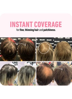 Boldify Hair Fibers (12G) Fill In Fine And Thinning Hair For An Instantly Thicker & Fuller Look - Best Value & Superior Formula -14 Shades For Women & Men - Black  - Image 3