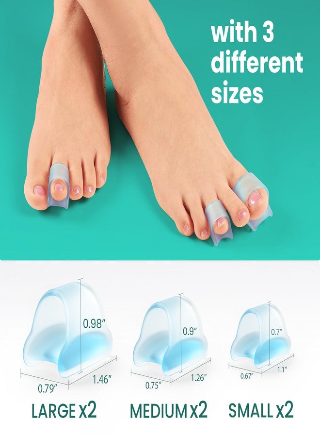 Welnove Hammertoe Corrector - 6 PCS Toe Splints Realign Bent, Curled, Crooked, Claw, Hammer Toes - Toe Straighteners for Men and Women, FSA or HSA eligible - Blue - Image 5