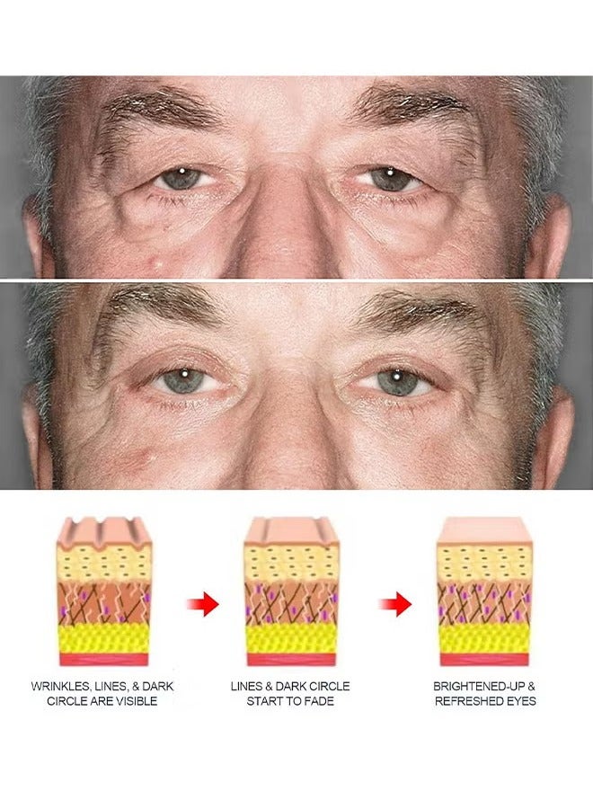 East Moon Rejuvenate Eyes Peptide Lifting Eye Gel, Eye Cream For Dark Circles And Puffiness, Anti-Aging Eye Cream For Men, Brightens Reduces Puffiness, Dark Circles And Fine Lines, Eye Treatment Gel For Men 30G - Image 5