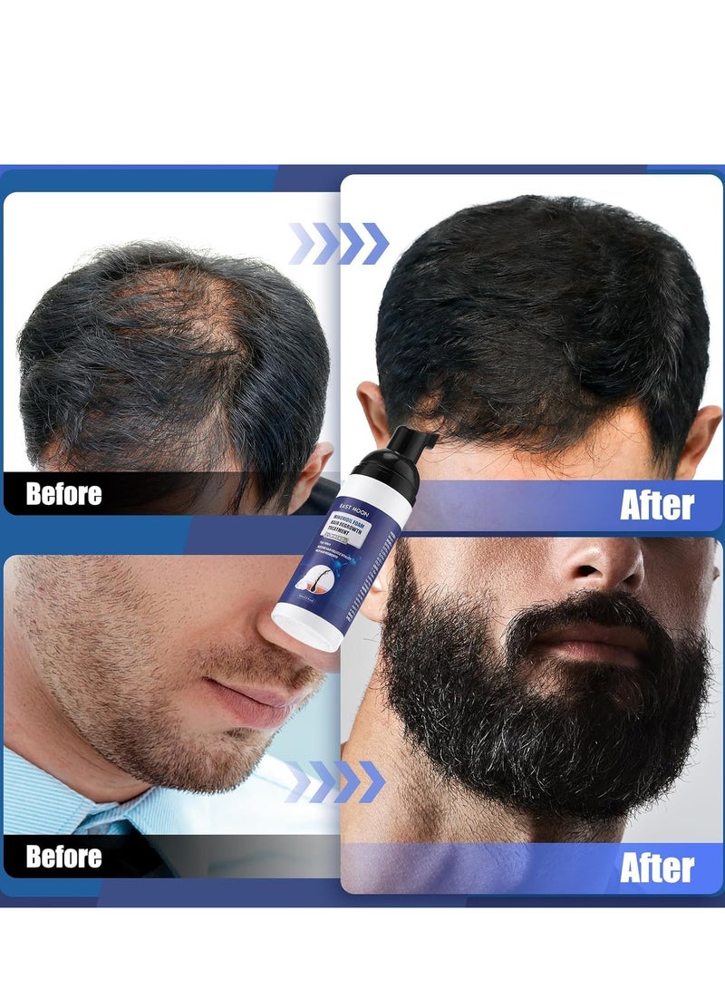 إيست مون رغوة إعادة نمو الشعر المينوكسيديل 5٪ للرجال والنساء - مكافحة تساقط الشعر وترققه وانحسار خط الشعر ، تعزز اللحية والشعر الأكثر كثافة - 2 أونصة - Image 3