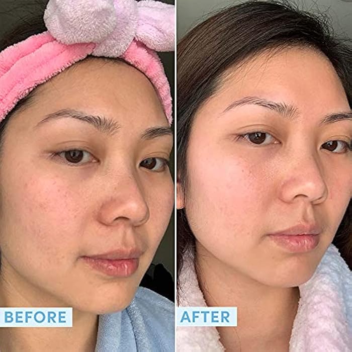 Sand & Sky Tasmanian Spring Water Hydrating Serum with Hyaluronic Acid & Probiotics - Fine Line Reducing Face Serum, Plumps Skin & Smooths Wrinkles, 1 fl oz - Image 4