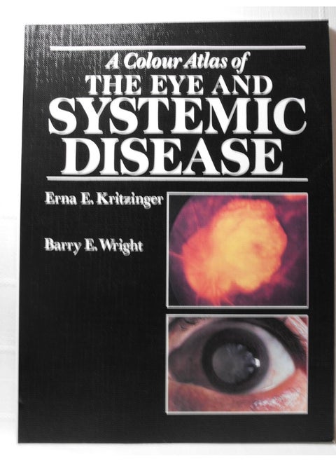 A Colour Atlas of the Eye and Systemic Diseases