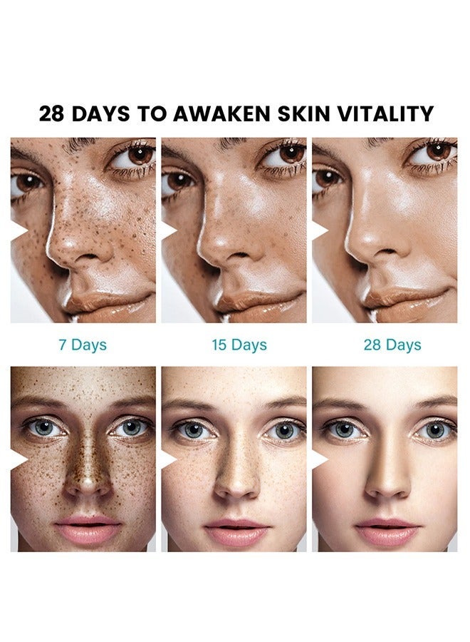 Sumifun 2 PCS Melasma Relief cream Pigmentation Removal Cream for Face, Freckle Remover Cream, Dark Spot Corrector Cream - Image 5