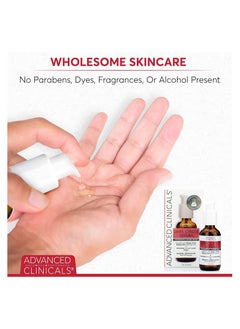 أدفانسد كلينيكال Advanced Clinicals Dark Circle Under Eye Serum Anti Aging Brightening Facial Treatment Targets Look Of Puffy Eyes, Crows Feet, & Sagging Skin W/ Vitamin C, Hyaluronic Acid, & Ferulic Acid, 1.75 Fl Oz  - Image 3