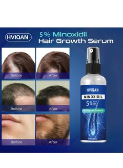 5% Minoxidil Hair Growth Spray For Men and Women 60Ml Hair Regrowth Treatment Serum For Stronger Thicker Longer Hair Help to Stop Thinning and loss hair - pzsku/Z630219ACA89C8C6A6E3CZ/45/_/1739168553/cff72bca-7993-4bab-b00c-ac2bef209b16