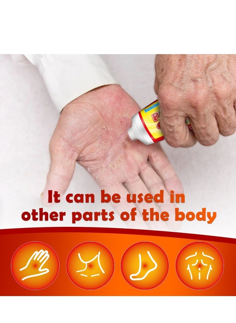 Sumifun psoriasis creamï¼Skin ringworm creamï¼Natural Chinese Herbal Eczema Psoriasis Creamsï¼effectively suppress psoriasis and itchy skin throug - Image 3