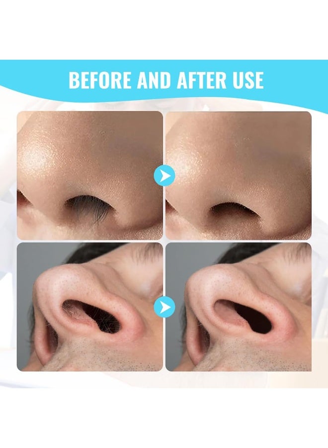 ماكينة تشذيب شعر الأنف المطورة مع فرشاة تنظيف، ماكينة تشذيب شعر الأنف المكونة من 5 قطع، سكين شعر الأنف الدوار بزاوية 360 درجة، أداة إزالة شعر الأنف المحمولة للإناث / الذكور - Image 4