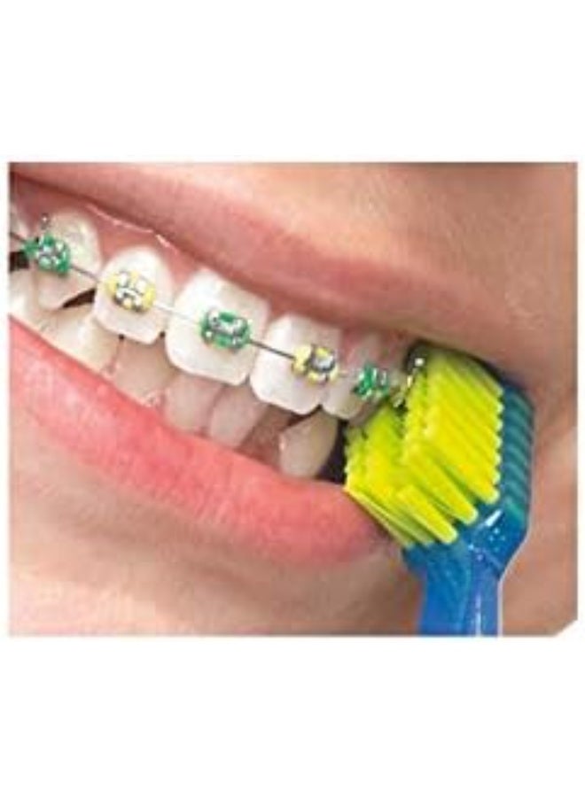 Curaprox Orthodontic Care Set – Complete Braces Cleaning Kit - Image 2