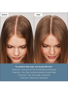 Briogeo Briogeo Scalp Revival Charcoal + Tea Tree Scalp Treatment, Scalp Serum to Soothe a Dry, Flaky, Itchy Scalp, Absorb Oil, Hydrate Dry Scalp, Clarify Build Up, Vegan, Cruelty-Free, 1 fl oz  - Image 4