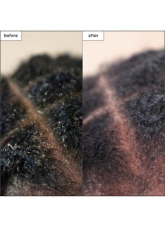 Briogeo Briogeo Scalp Revival Charcoal + Tea Tree Scalp Treatment, Scalp Serum to Soothe a Dry, Flaky, Itchy Scalp, Absorb Oil, Hydrate Dry Scalp, Clarify Build Up, Vegan, Cruelty-Free, 1 fl oz  - Image 3