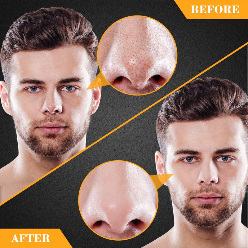Charmonic Blackhead Pore Strips, 33 pcs Charcoal Peel Off Strips, Blackhead Remover Pore Strips for Men, Deep Cleansing Strips Remove for Nose Area and Face Oil and Blackheads - Image 5