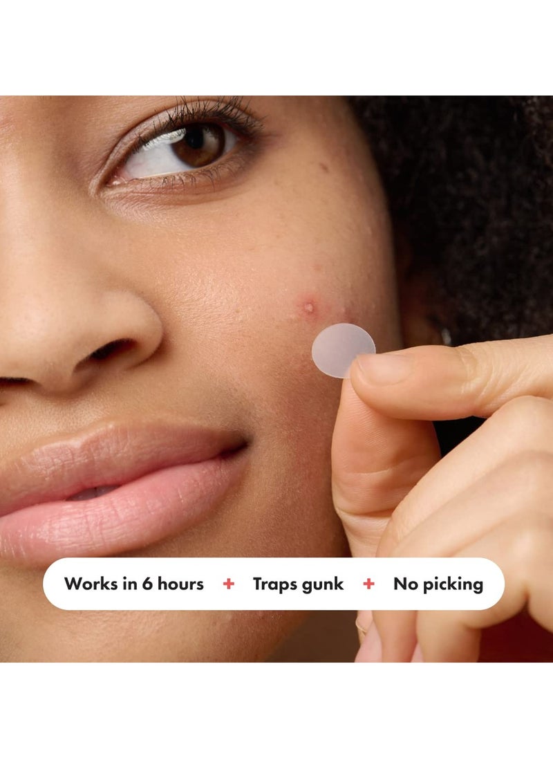Mighty Patch Hydrocolloid Acne Pimple Patch Spot Treatment 72- Piece  - Image 4