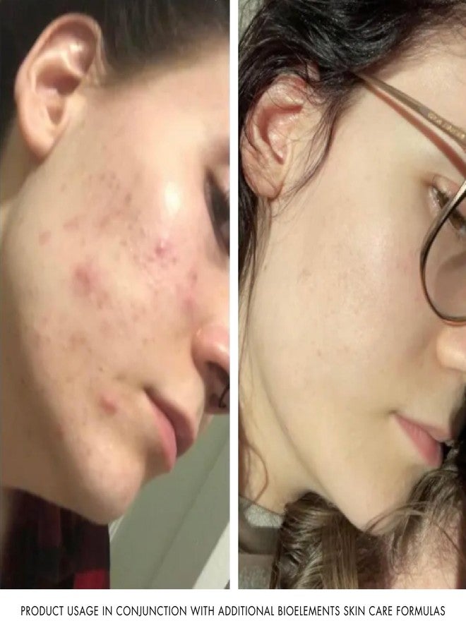 بايو إيلمينتس قناع الوجه Bioelements Kerafole - 75 مل - قناع تنظيف عميق للبشرة، لبشرة نضرة ومشرقة - نباتي، خالٍ من الغلوتين - لم يُجرَّب على الحيوانات - Image 5