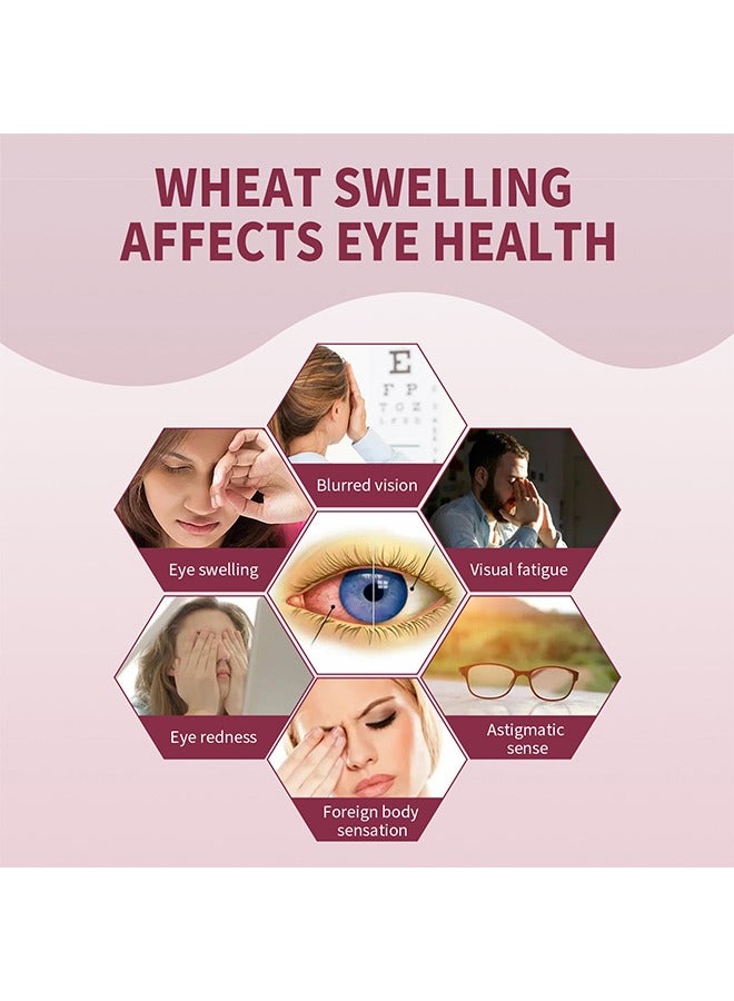 Jaysuing Stye Eye Relief Serum 30ml, Stye Eye Treatment, Eye Stye Remover, Chalazion Remover, Stye Eye Relief Serum for Styes Chalazion and Blepharitis Treatment, Eye Care, Mild Lash and Eye Cleanser - Image 2