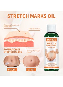 Pregnancy Massage Oil Repair Pregnant Women Prenatal and Postpartum Stretch Marks Growth Marks Skin Care Massage Oil