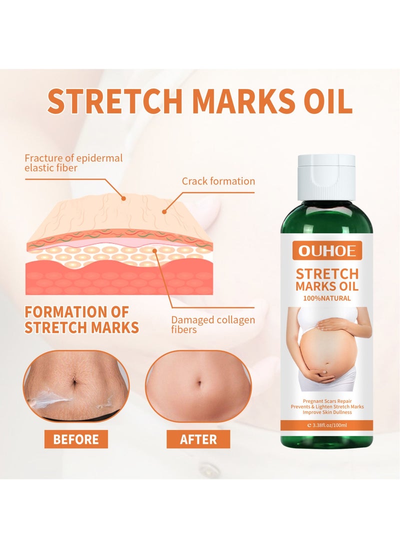 OUHOE - Pregnancy Massage Oil Repair Pregnant Women Prenatal and Postpartum Stretch Marks Growth Marks Skin Care Massage Oil - Image 1