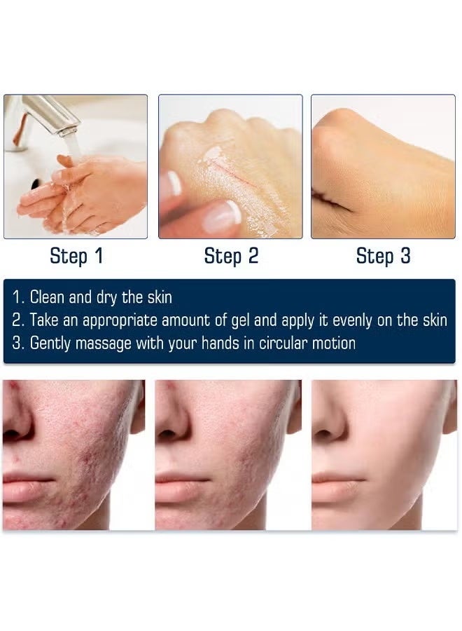 West&Month Silicone Scar Removal Gel, Hight Quality Scar Removal Gel, Acne Scar Treatment, Deep Acne Scar Removal, Burns Keloids Hypertrophic, Repair Damaged Skin, Removing Acne Marks Scar Repair Cream ﻿ - Image 3