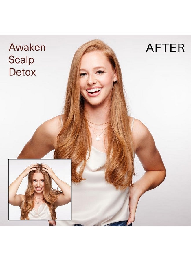 Surface Awaken Scalp Detox, 6fl. Oz. - Image 3
