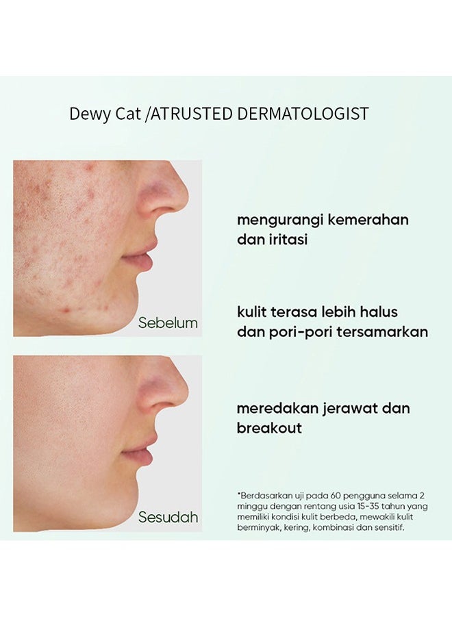 West&Month Mugwort Acne Clay Stick, Mugwort Anti Pores And Acne Clay Mask, Cleansing Mask Mud Mask For Men And Women, Moisturizing Oil Control Shrink Remove Blackheads, Shrink Pores, Improve Skin Tone 40g  - Image 4