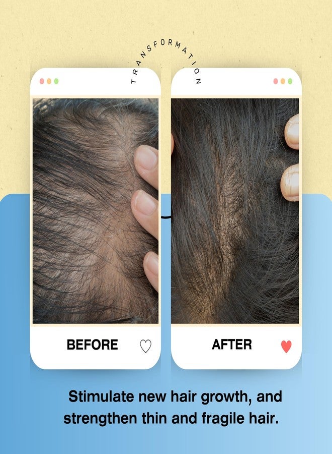 Mediceuticals Bioclenz Shampoo - Anti-Shedding Shampoo for Women and Men - Shampoo for Hair Loss Due to Telogen Effluvium - Postpartum Hair loss Shampoo - For Normal Hair and Scalp 33.8 oz (1L) - Image 5