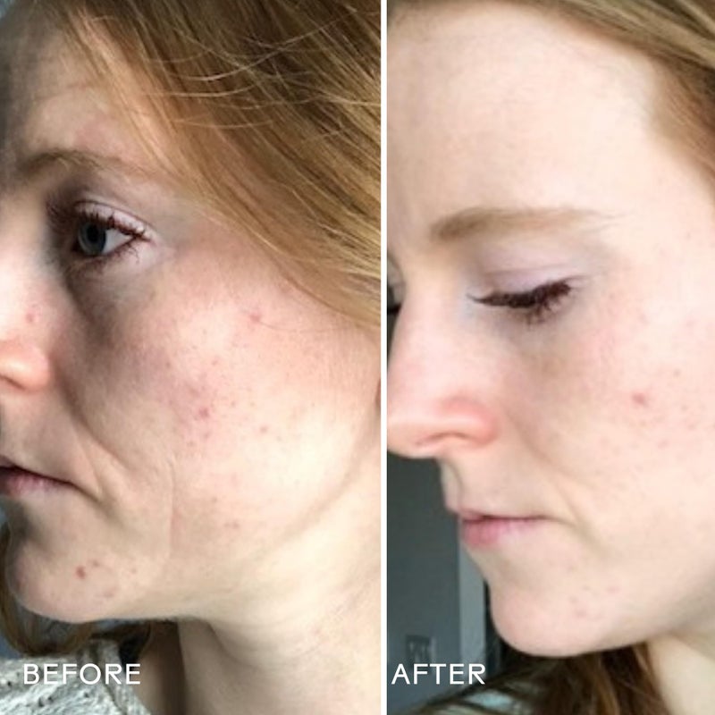 Three Ships - Refresh Papaya + Salicylic Acid Cleanser | Smooth, Cleanse, Refresh Skin | Cruelty-Free, Vegan, Paraben-Free, Sensitive Skin Safe (3.4 fl oz | 100 mL) - Image 4