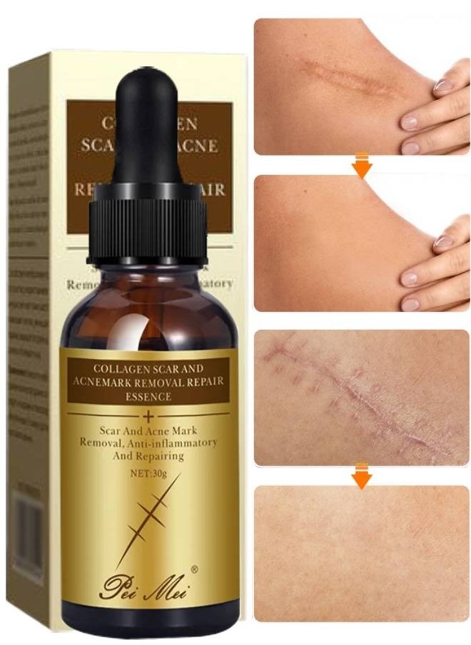 Pei Mei Collagen Scar and Acne Mark Removal Repair Essence Moisturizing Soothing Facial Scar Removal Serum Collagen Skincare Serum Stretch Marks Serum Skin Repair Nourishing Serum Fat Streaks Removal Serum  - Image 1