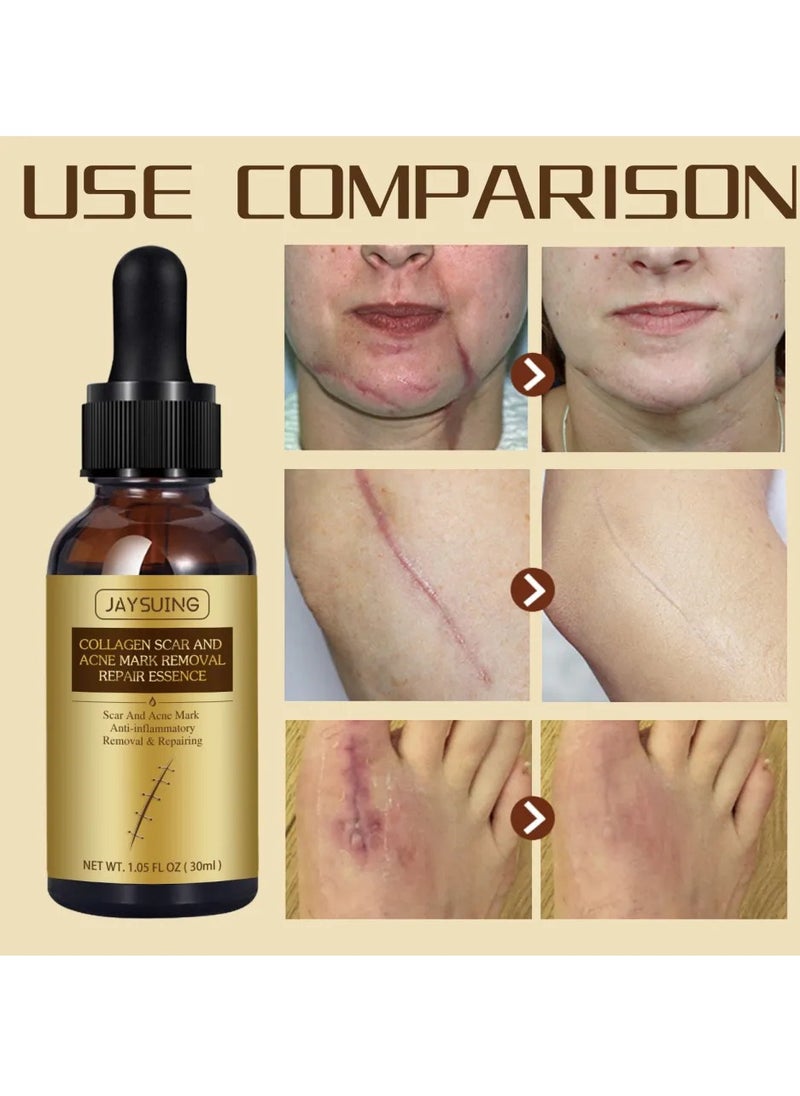 Pei Mei Collagen Scar and Acne Mark Removal Repair Essence Moisturizing Soothing Facial Scar Removal Serum Collagen Skincare Serum Stretch Marks Serum Skin Repair Nourishing Serum Fat Streaks Removal Serum  - Image 2