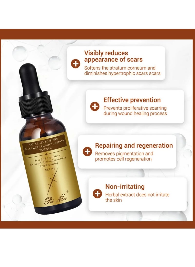 Pei Mei Collagen Scar and Acne Mark Removal Repair Essence Moisturizing Soothing Facial Scar Removal Serum Collagen Skincare Serum Stretch Marks Serum Skin Repair Nourishing Serum Fat Streaks Removal Serum  - Image 3