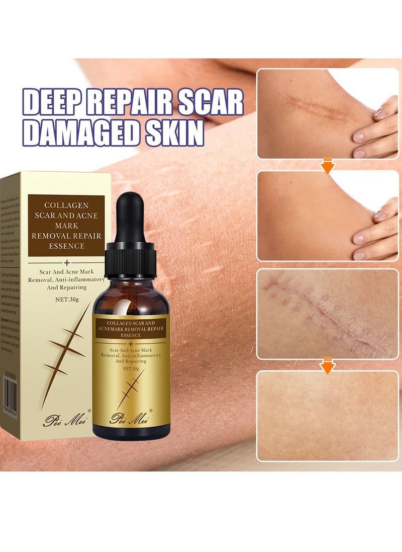 Pei Mei Collagen Scar and Acne Mark Removal Repair Essence Moisturizing Soothing Facial Scar Removal Serum Collagen Skincare Serum Stretch Marks Serum Skin Repair Nourishing Serum Fat Streaks Removal Serum  - Image 5