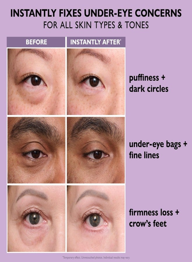 Peter Thomas Roth | Instant FIRMx® Eye Temporary Eye Tightener Easy-Wear Formula - Image 4