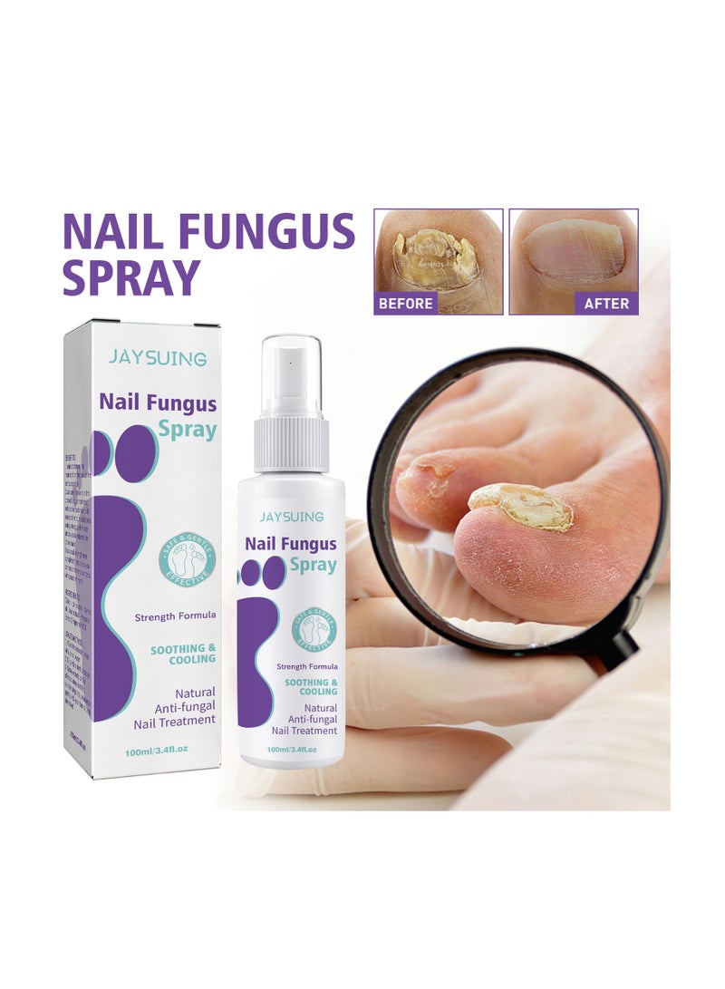 Jaysuing Nail Fungus Spray for Nail Repair Solution Onychomycosis Care - Image 1