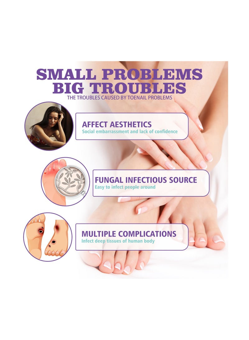 Jaysuing Nail Fungus Spray for Nail Repair Solution Onychomycosis Care - Image 3