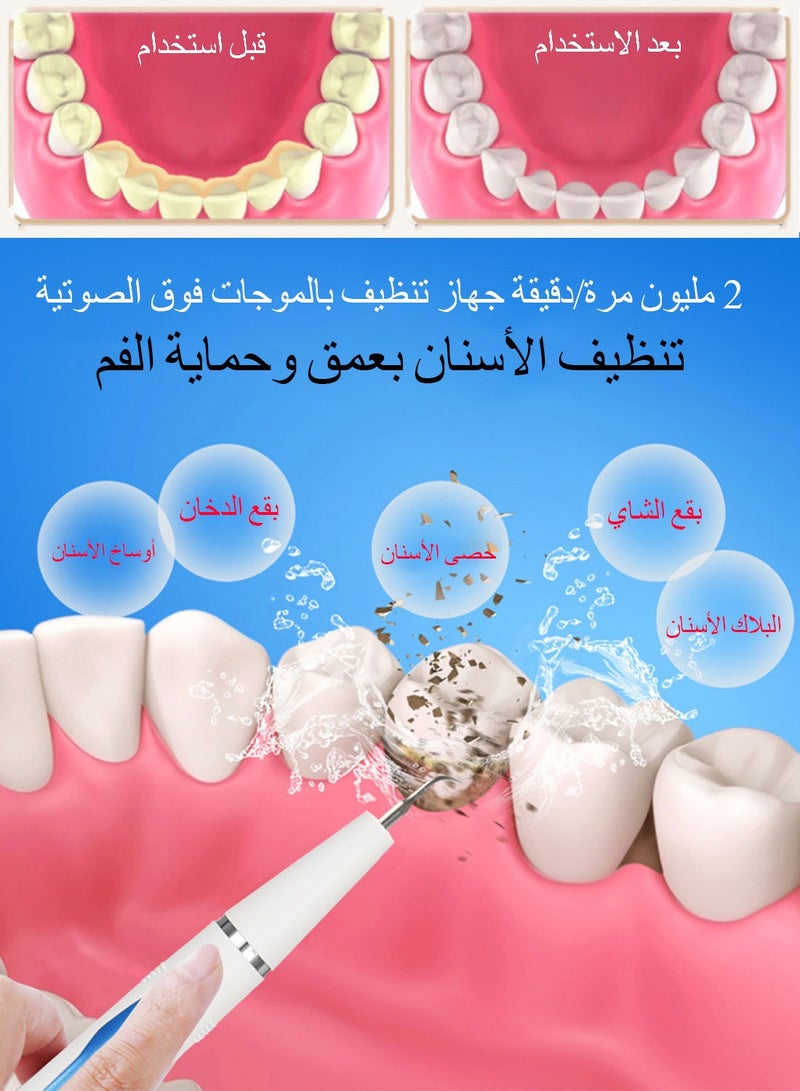 Syarme Plaque Remover for Teeth, Electric Tooth Cleaner Tartar Remover for Teeth with LED Light, Rechargeable Teeth Cleaning Kit, Dental Tools with 5 Modes and 4 Cleaning Heads, Including Storage Box - Image 4