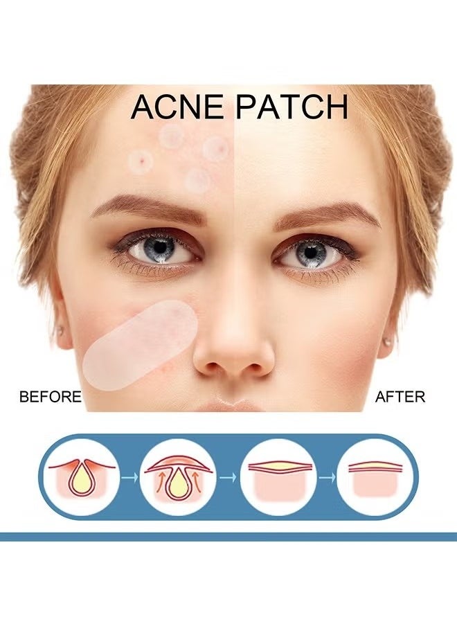 EELHOE Acne Patch Large Pimple Patches -Big Acne Patches, XL Hydrocolloid Bandages for Full Face, Forehead, Chin, Nose, Body, Back, Neck & Chest, Oval, Moon, Square hydrocolloid Patch ( 80 Patches)  - Image 2