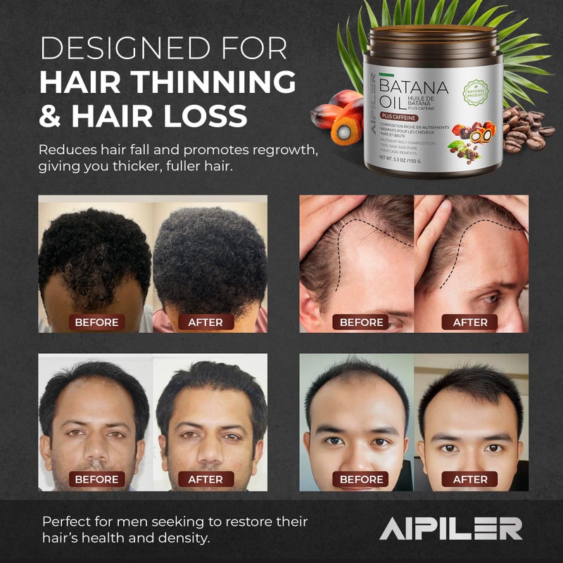 AIPILER Batana Oil for Hair Strenthening: Dr Sebi 100% Pure and Raw Honduras Hair Treatment Oil - Pre or Post Shower Hair care for Curly/Coily/Wavy Hair 5.3oz (Caffeine) - Image 3