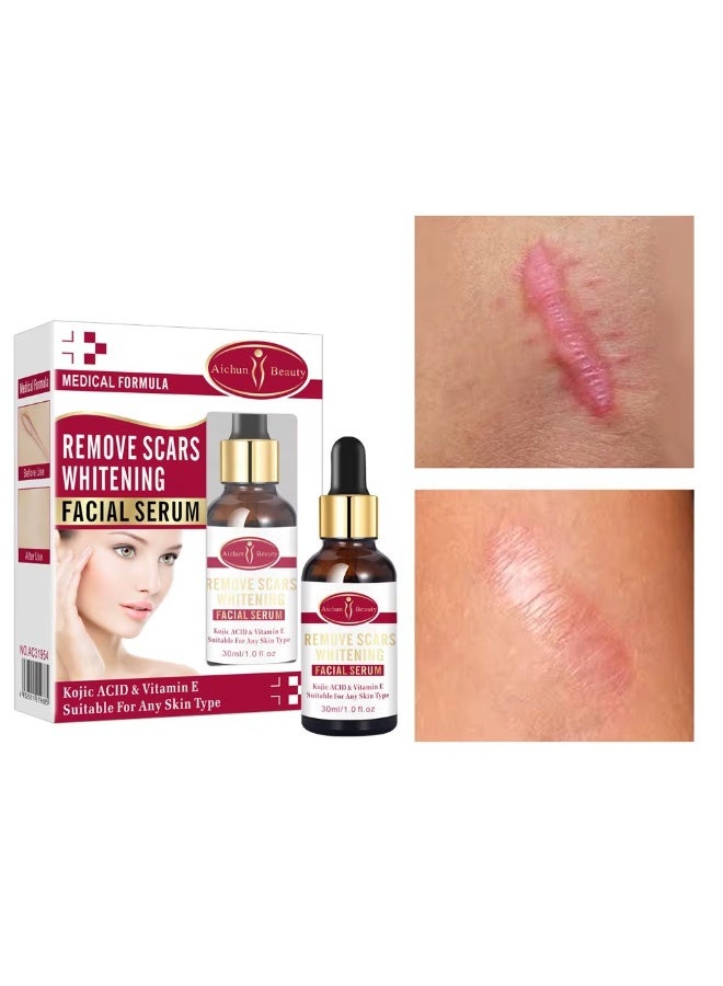 Aichun beauty Remove Scars Whitening Facial Serum Kojic Acid Vitamin E 30ml Face Brightening Lightening Dark Spot Remover Skin Repair Moisturizing Anti Acne Anti Pigmentation - Image 2