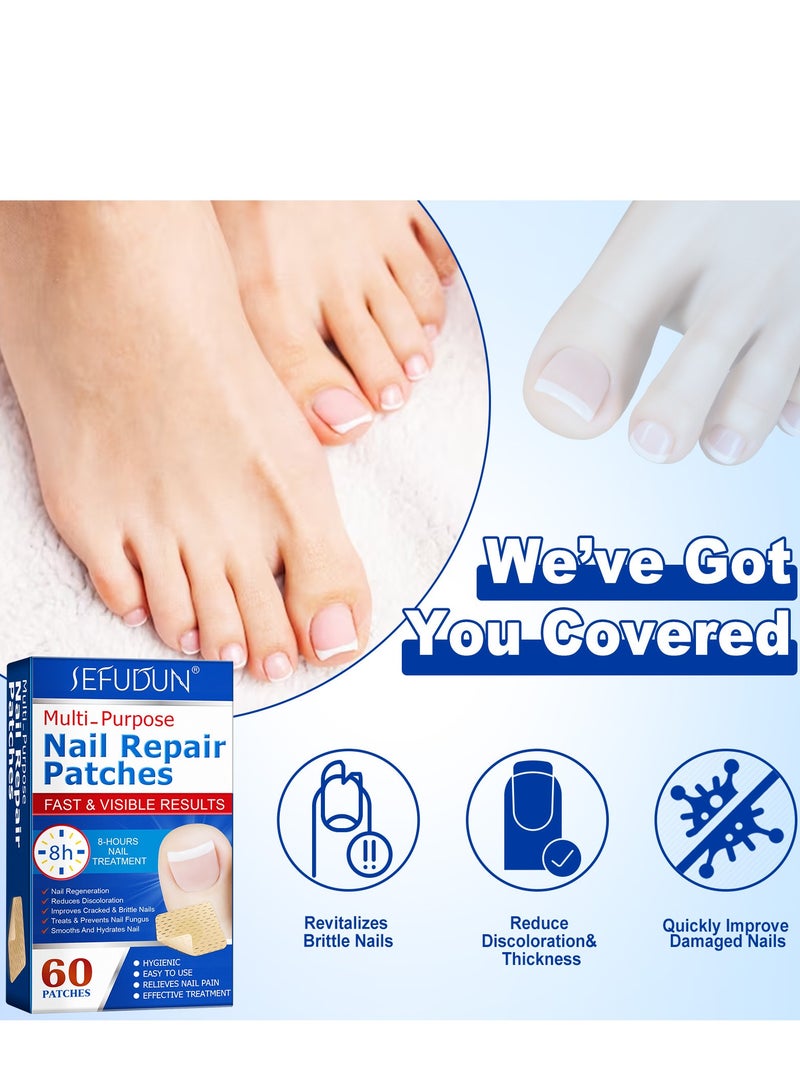 Sefudun SEFUDUN nail repair patch ingrown nails, onychomycosis, thick nail correction patch, manicure, brittle nail care patch 60pcs  - Image 5