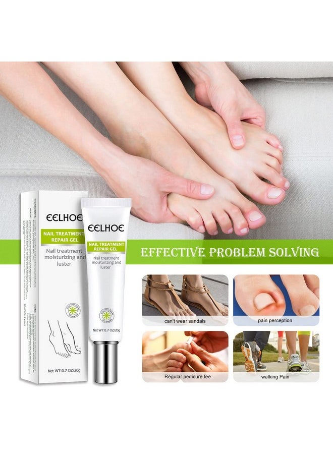 2Pcs Efero Nail Treatment Repair Gel Nail Repair Cream Nail Repair Essence Gel Toe Be Health Instant Beauty Gel Toenail Treatment & Care Under The Nail Restores Discolored Or Damaged Nails - pzsku/Z6396E5CCB1708FB047B6Z/45/_/1720698526/a86fc2dc-f0ef-4697-8be6-4a7e1fc9d674