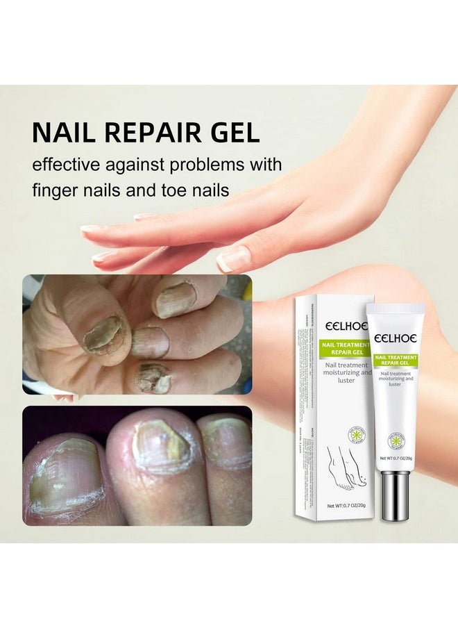 2Pcs Efero Nail Treatment Repair Gel Nail Repair Cream Nail Repair Essence Gel Toe Be Health Instant Beauty Gel Toenail Treatment & Care Under The Nail Restores Discolored Or Damaged Nails - pzsku/Z6396E5CCB1708FB047B6Z/45/_/1720698529/69736c85-f62f-43fd-97a4-44998c68a2c5