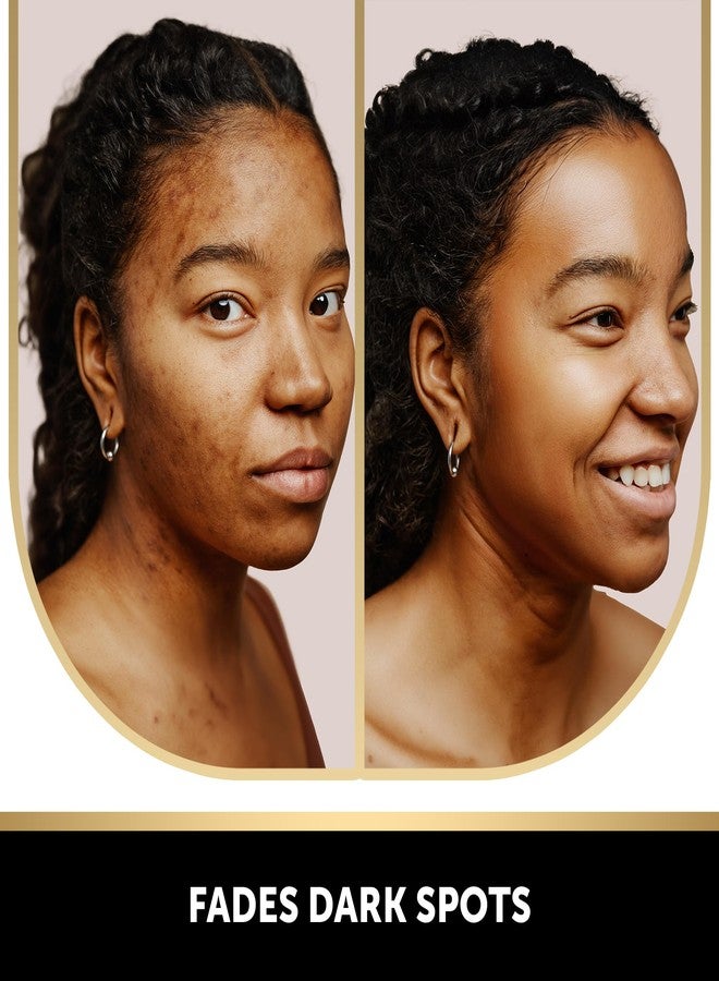 VALITIC 2 Pack Kojic Acid Vitamin C & Retinol Soap Bars for Dark Spot & A Pair of Turquoise Exfoliating Gloves for Body Scrubs - Image 2