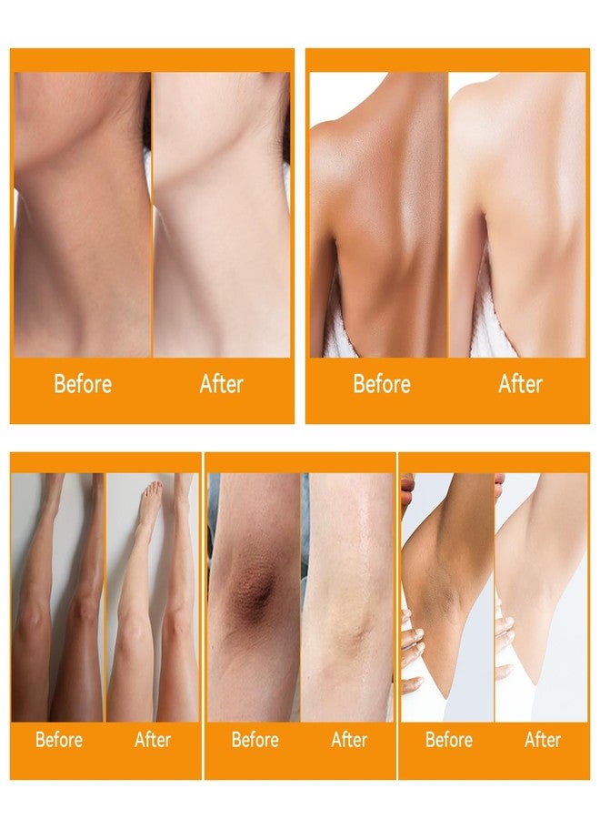 YAFUSIPE Dark Knuckle Remover Underarm Cream Body Moisturizer Lotion Dark Toe Knuckles Treatment Removal Remover Corrector for Armpit Knees Elbow Inner Thigh Neck Private Part Intimate Skin Cream 4.21floz/120g - Image 3