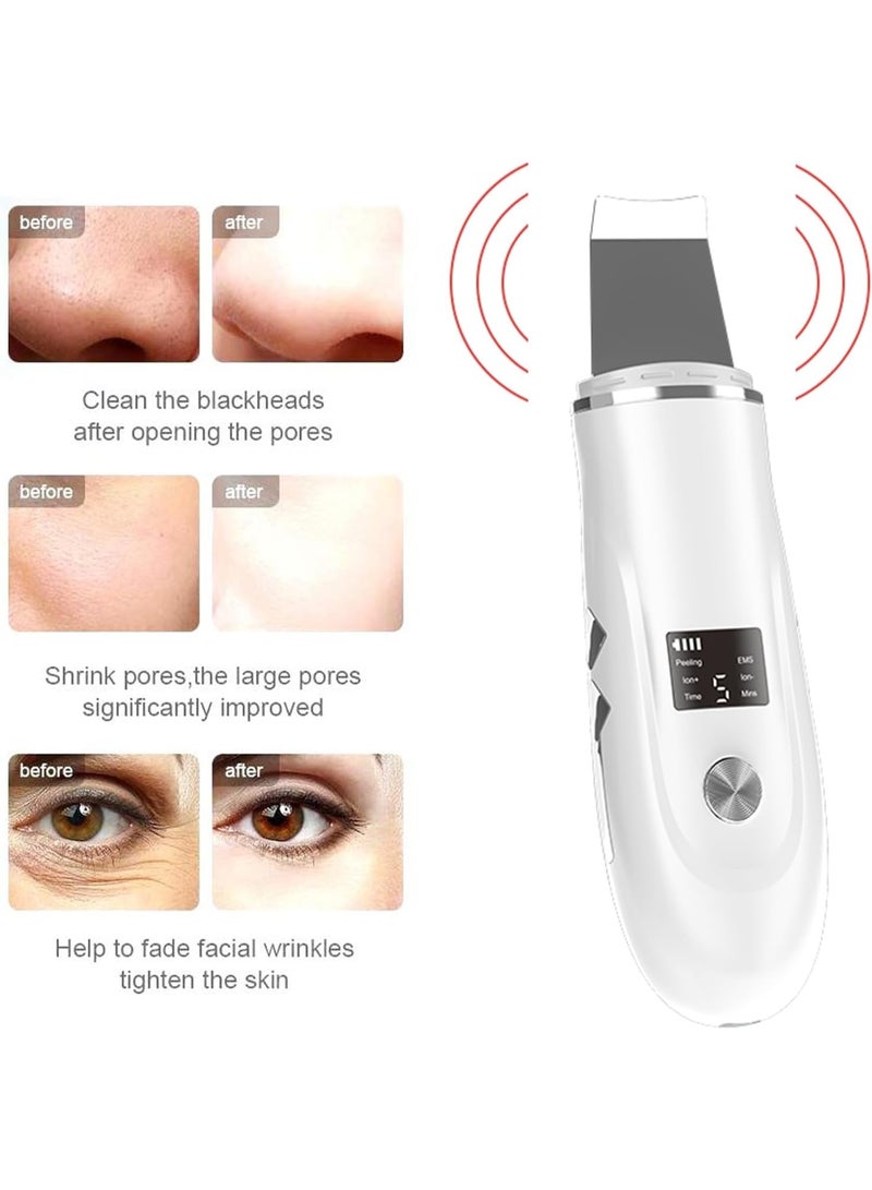 Ultrasonic Facial Cleansing Device – Deep Pore & Blackhead Cleaner – 4-Mode Skin Care Tool for Daily Use - Image 4