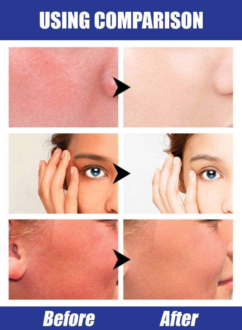 EELHOE Sun Hyaluronic Acid Stick，Hyaluronic Acid Watery Sun Gel , Contain Chemical Sub Blocks SPF50+ UVA/UVB To Protect Skin From UV Rays, Can Blend Into The Skin Perfectly Under Makeup As Well，Sunscreen Cream - Image 4