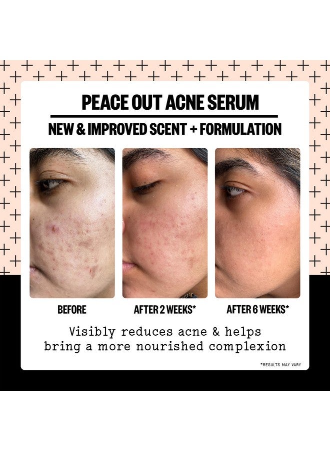Peace Out Skincare Acne Serum. Daily Multi-Benefit Face Serum with 2% Salicylic Acid to Target Pimples, Zits, Blemishes and Breakouts, For Clearer-Looking Skin 1 fl oz - Image 4