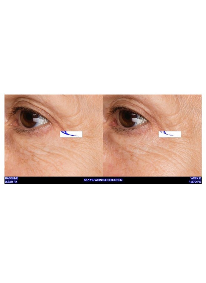 Serious Skincare Ultra-Mare Pure Marine Infusion Revitalizing Eye Cream - Peptides - Skin Renewing - Encourages Collagen Production - Helps Reduce Wrinkle Depth - 0.5 oz  - Image 2
