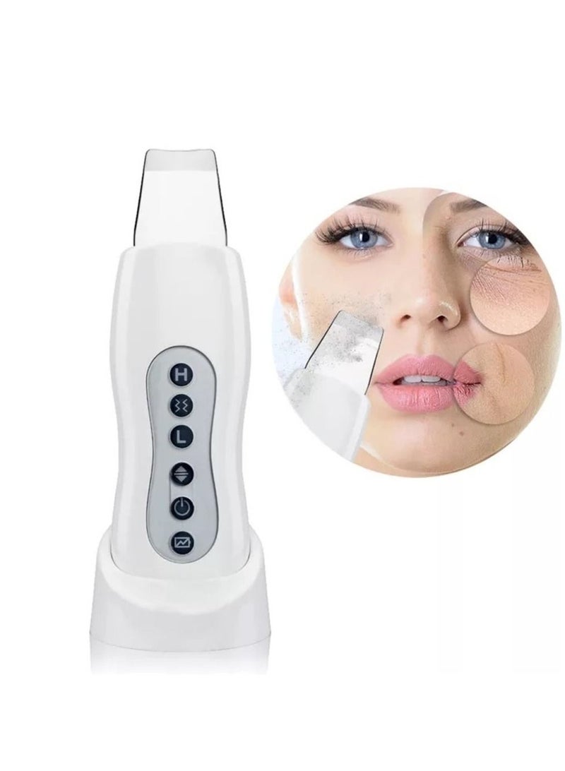 Calla Ultrasonic Facial Skin Scrubber Blackhead Remover USB Charger Pore Cleanser and Lifting Tool - Image 1