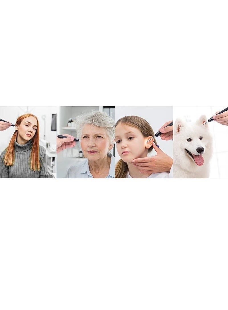 Bukela Ear Wax Removal, Wi-Fi Visible Wax Elimination Spoon with 4 Soft Silicone Ear Scoops, Wireless Ear Endoscope 1296P HD with LED Light for iPhone, iPad, Android Phones (Black) - Image 4