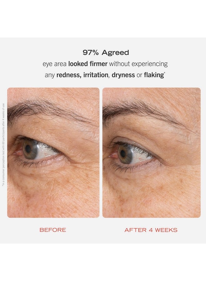 فيرست إيد بيوتي كريم ريتينول للعين من فيرست إيد بيوتي مع سكوالين وسيراميد، سيروم ريتينول مُغلّف للبشرة الحساسة، يُساعد على تحسين مظهر الخطوط الدقيقة والتجاعيد، آمن للبشرة الحساسة، 0.5 أونصة - Image 2